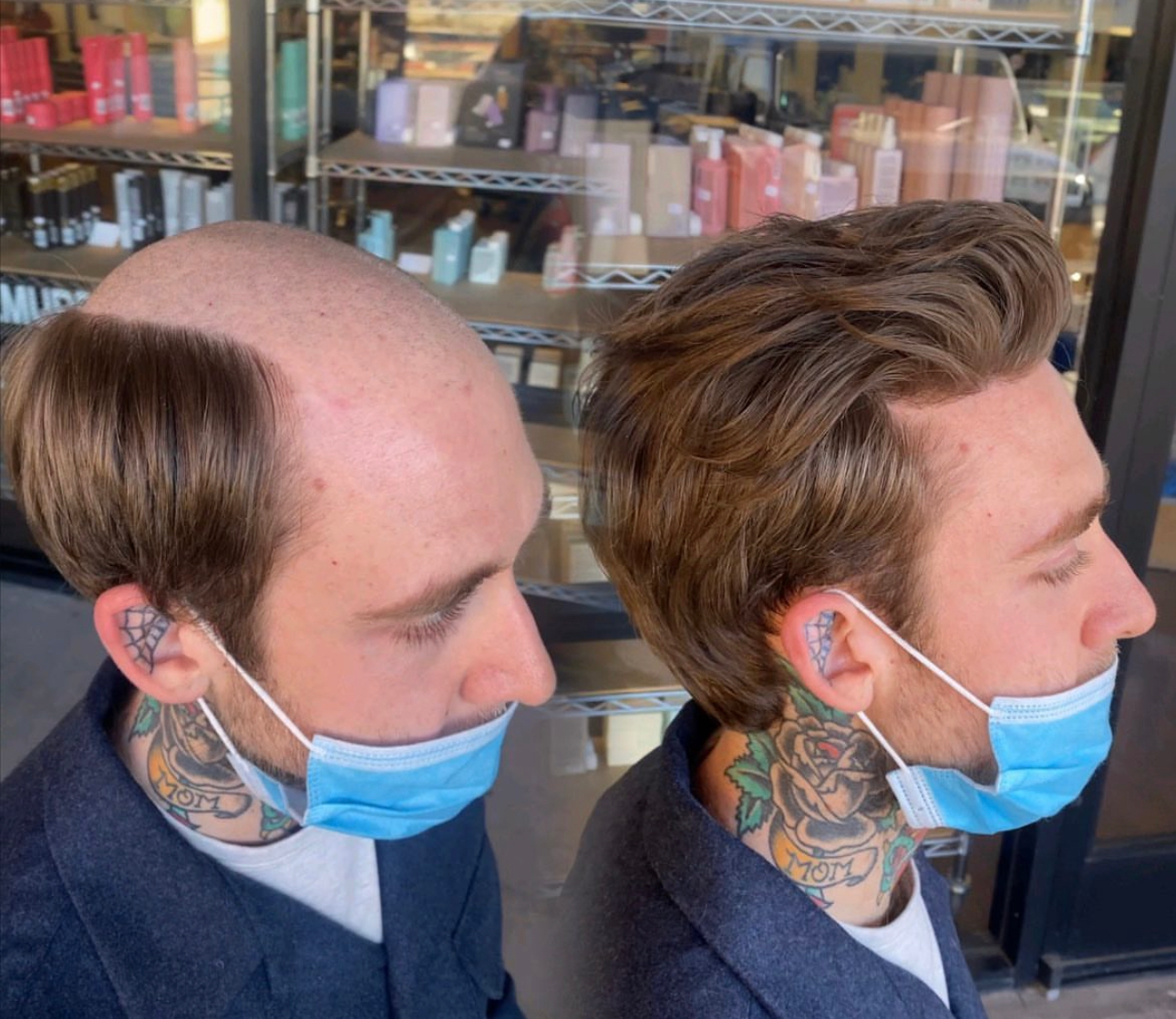 Men's hair system before-and-after result for a consultation at The Men's Grooming Suite